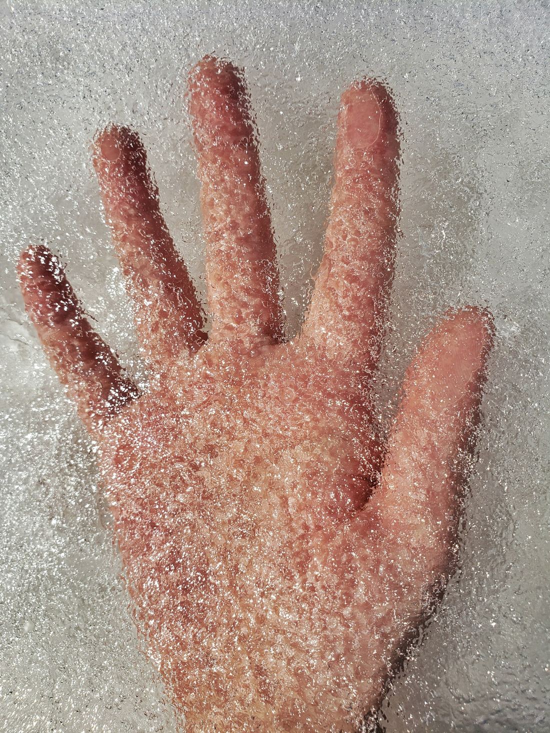 A hand pressed flat into crushed ice, skin flushed red